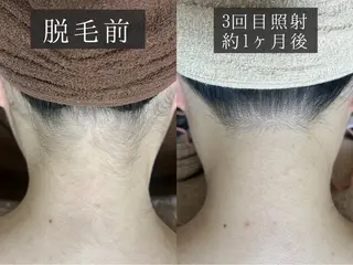 脱毛専門サロン BELFINE恵比寿のエステ・リラクイメージ