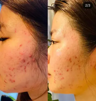 整♡深層リンパ ronronのその他イメージ