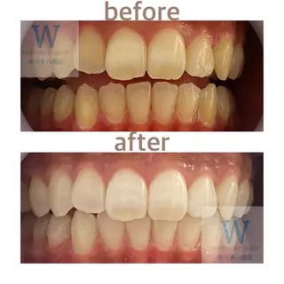 ホワイトニング ショップ本八幡店のエステ・リラクイメージ