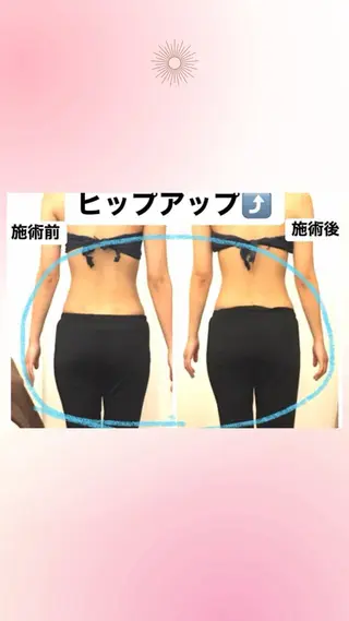 骨格美セラピーfuwari所属・fuwariオーナー じゅんこのエステ・リラクイメージ