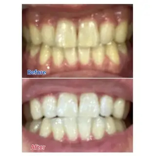 M渋谷店所属・M渋谷 ホワイトニングのその他イメージ