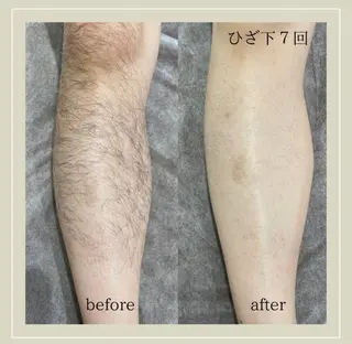 メンズ Chareir Homme所属・chareir homme菅原のエステ・リラクイメージ