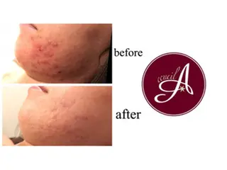 ミディアム カラー パーマ ヘアアレンジ メンズ キッズ ネイル マツエク・マツパ ニキビ・肌質改善専門 ♡人生が変わるサロンのエステ・リラクイメージ