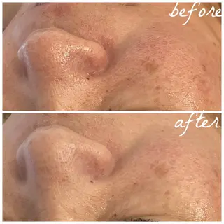 メンズ メナード岐阜市茜部 杉浦のエステ・リラクイメージ