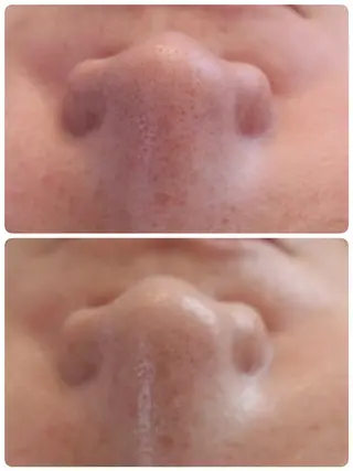 エステサロン NICOLIのエステ・リラクイメージ