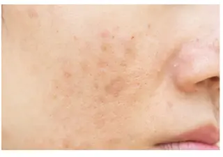 Empreinte (アンプラント)のエステ・リラクイメージ