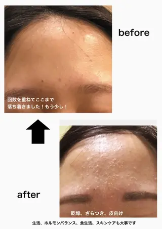 M. lisyelのエステ・リラクイメージ