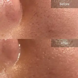 Mandarin Orange所属・毛穴から始める肌メン テマンダリンオレンジのエステ・リラクイメージ