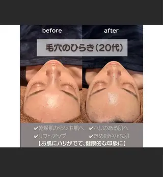 Moana【モアナ】 HIROのエステ・リラクイメージ