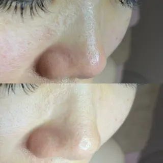 毛穴ケア・ヘッドスパサロンSHINY(シャイニー)所属・毛穴ケア・ヘッドスパ サロンSHINYのエステ・リラクイメージ