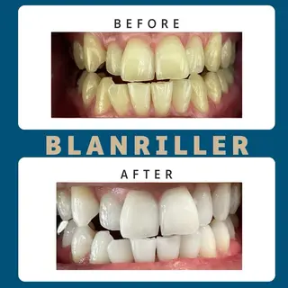 BLANRILLER所属・ホワイトニングサロン ブランリエ阿倍野店のその他イメージ