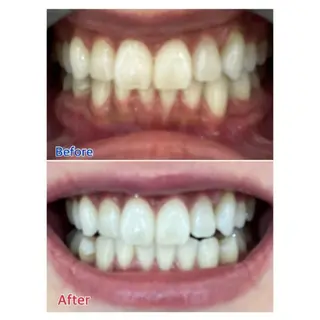 M渋谷店所属・Ｍ渋谷 ホワイトニングのその他イメージ