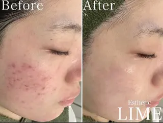 韓国肌管理Belle後楽園所属・韓国肌管理Belle 後楽園のエステ・リラクイメージ