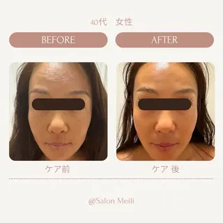 バリ式アロマ＆フェイ シャル_chiakiのエステ・リラクイメージ