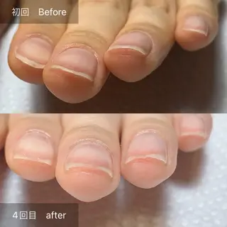 ネイル 木村 千晴のネイルデザイン