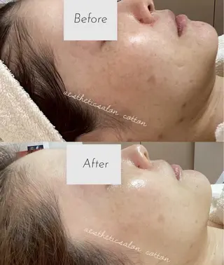 都度払い 肌質改善専門サロンのエステ・リラクイメージ