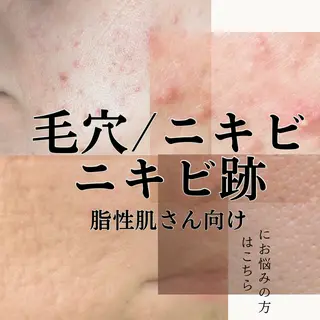 シミ毛穴ケア EsteAのエステ・リラクイメージ