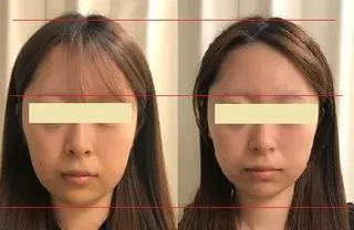 顔脱毛＆毛穴＆ニキビ 優良№1♪ヒロコ♪のエステ・リラクイメージ