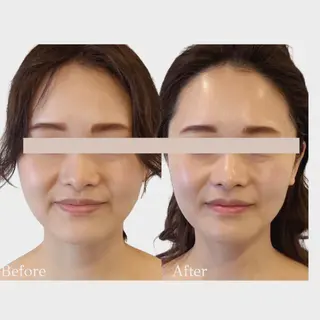 看護師 AYUIのエステ・リラクイメージ