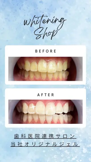ホワイトニングショップ　高松瓦町店所属・ホワイトニング ショップ 高松瓦町のその他イメージ