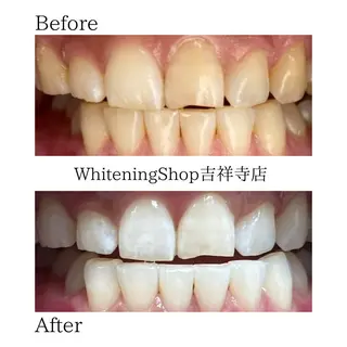 ホワイトニング ショップ吉祥寺店のエステ・リラクイメージ