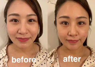 美容鍼灸サロン mahoroba院長のエステ・リラクイメージ