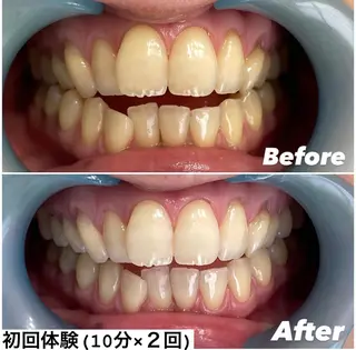 ホワイトニング専門店 Hi-Whiteのその他イメージ