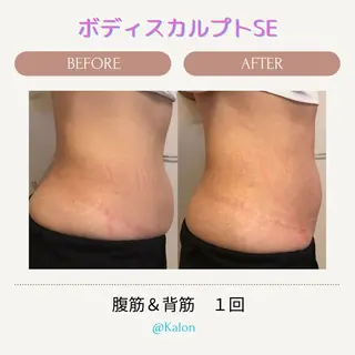 大名 Kalon（カロン）のエステ・リラクイメージ