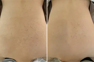 肌質改善 KALANCHOEのエステ・リラクイメージ