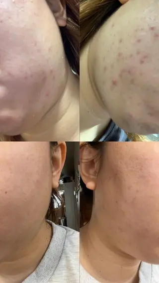 メナードフェイシャルサロン深井清水店所属・吉田 茜のエステ・リラクイメージ