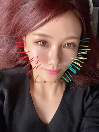 鍼灸整骨院Refine所属・鍼灸 Refineのその他イメージ