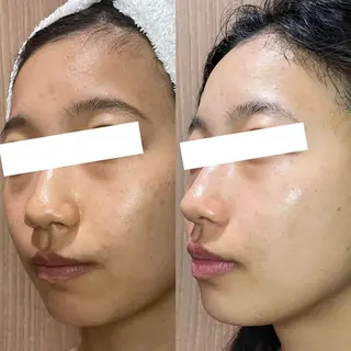 堀江リンパマッサージ 小顔×美肌×バストのエステ・リラクイメージ