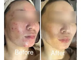 Avenir Brillant所属・松田 紗季のエステ・リラクイメージ