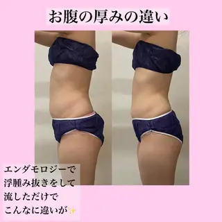 B againのエステ・リラクイメージ