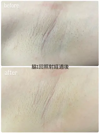 DISINI  SPA所属・DISINISPA 脱毛/フェイシャルのエステ・リラクイメージ