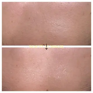 ビューティー ミロワールのエステ・リラクイメージ