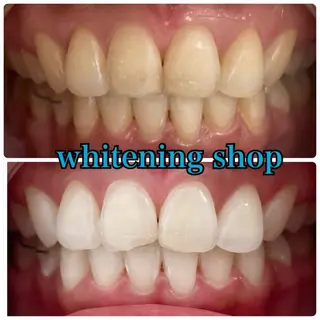 メンズ ホワイトニング ショップ川越店のエステ・リラクイメージ