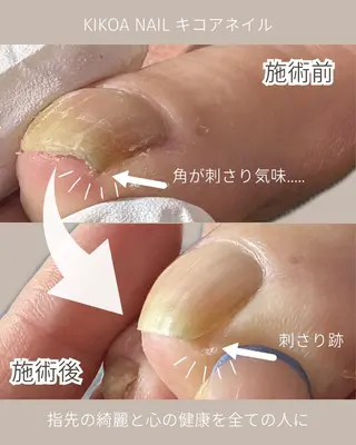 ネイル KIKOA NAIL キコアネイルのネイルデザイン