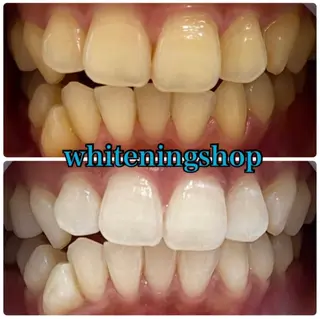 ホワイトニング ショップ吉祥寺店のエステ・リラクイメージ