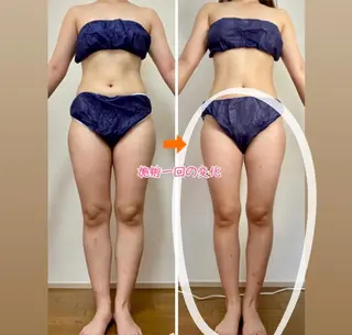 ショート カラー パーマ ヘアアレンジ メンズ キッズ ネイル マツエク・マツパ ‍痩身＆ボディ 結果出し🌟丹野のエステ・リラクイメージ