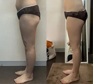 ハイパーナイフ専門店 Salon de COCO所属・Salon de COCOのエステ・リラクイメージ