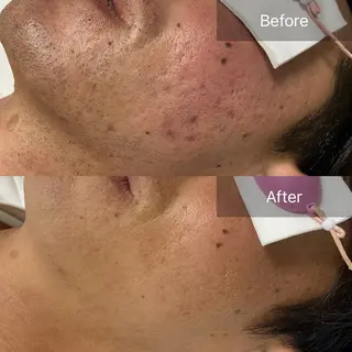 メンズ 港区都度払い脱毛 miranjuのエステ・リラクイメージ