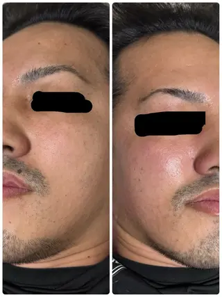 メンズ 三原 裕紀のマツエク・マツパデザイン