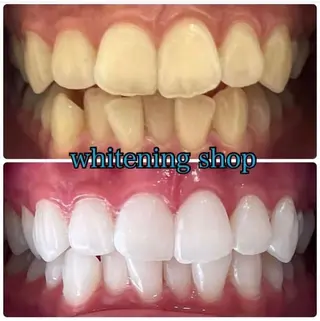 ホワイトニング ショップ吉祥寺店のエステ・リラクイメージ