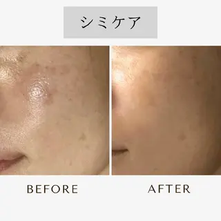 ICHOOSE/ 代々木上原のエステ・リラクイメージ