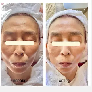 grow所属・Yoshino Erinaのエステ・リラクイメージ