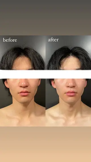 エステサロンino.colore'所属・小顔サロン ino.coloreのエステ・リラクイメージ