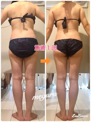 ショート カラー パーマ ヘアアレンジ メンズ キッズ ネイル マツエク・マツパ ‍痩身＆ボディ 結果出し🌟丹野のエステ・リラクイメージ