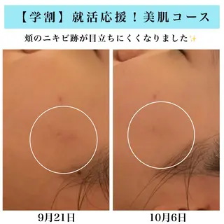 Bellesthe （ベルエステ）のエステ・リラクイメージ