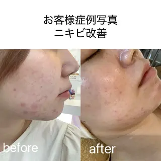 CPサロンビバーチェ所属・CPサロン ビバーチェのエステ・リラクイメージ